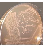 СОРБИТОЛ E. coli O157:H7 АГАР